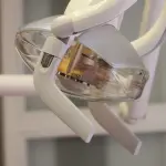 Il miglior centro per le Faccette Dentali