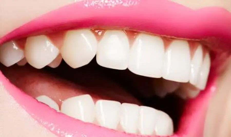 Impianti dentali e dentisti a Brescia