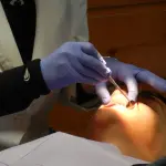 Cura del sorriso: affrontarla grazie all'implantologia dentale